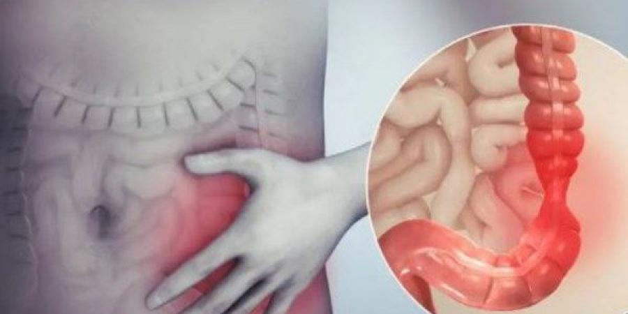 رغم فوائده الخارقة .. هؤلاء الممنوعون من القرنفل - لايف نيوز